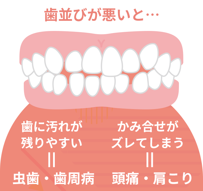 歯や全身の健康に影響